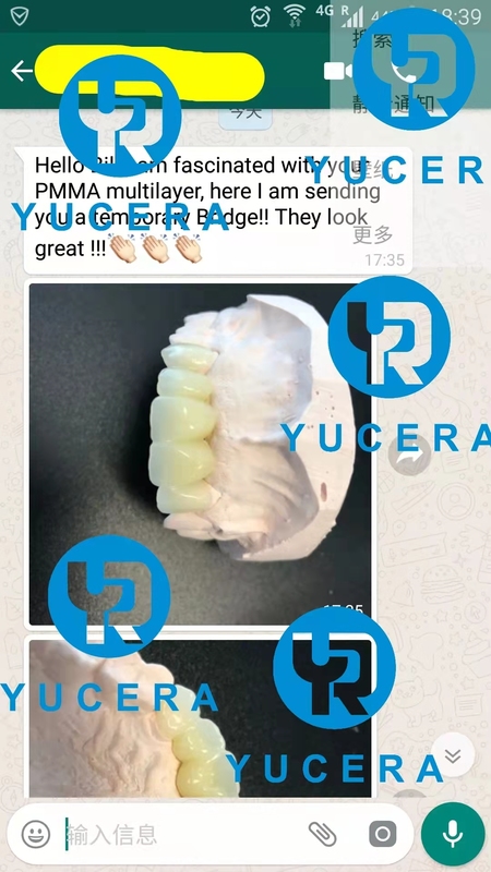 13mm 16mm 20mm A-D Shades Multilayer PMMA Block AG System for Long-term Temporary Restorations