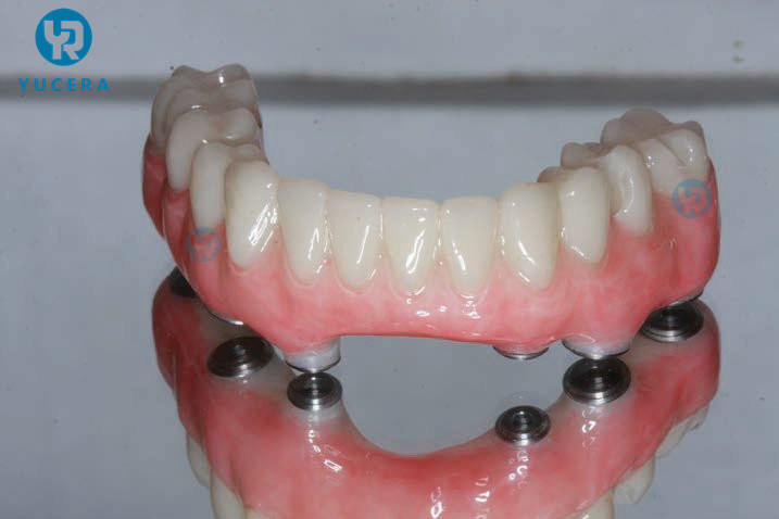 13mm 16mm 20mm A-D Shades Multilayer PMMA Block AG System for Long-term Temporary Restorations