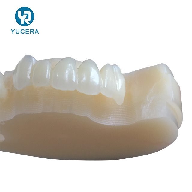 13mm 16mm 20mm A-D Shades Multilayer PMMA Block AG System for Long-term Temporary Restorations
