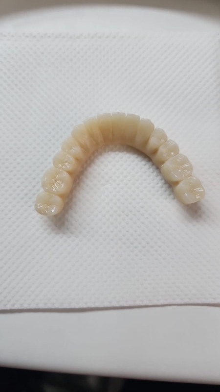 Yucera 4D Pro High - Precyzyjny 3D Wielowarstwowy Blok Cyrkonu Dentystycznego Stabilny i Niezawodny Tworzący Idealne Wyniki Odbudowy
