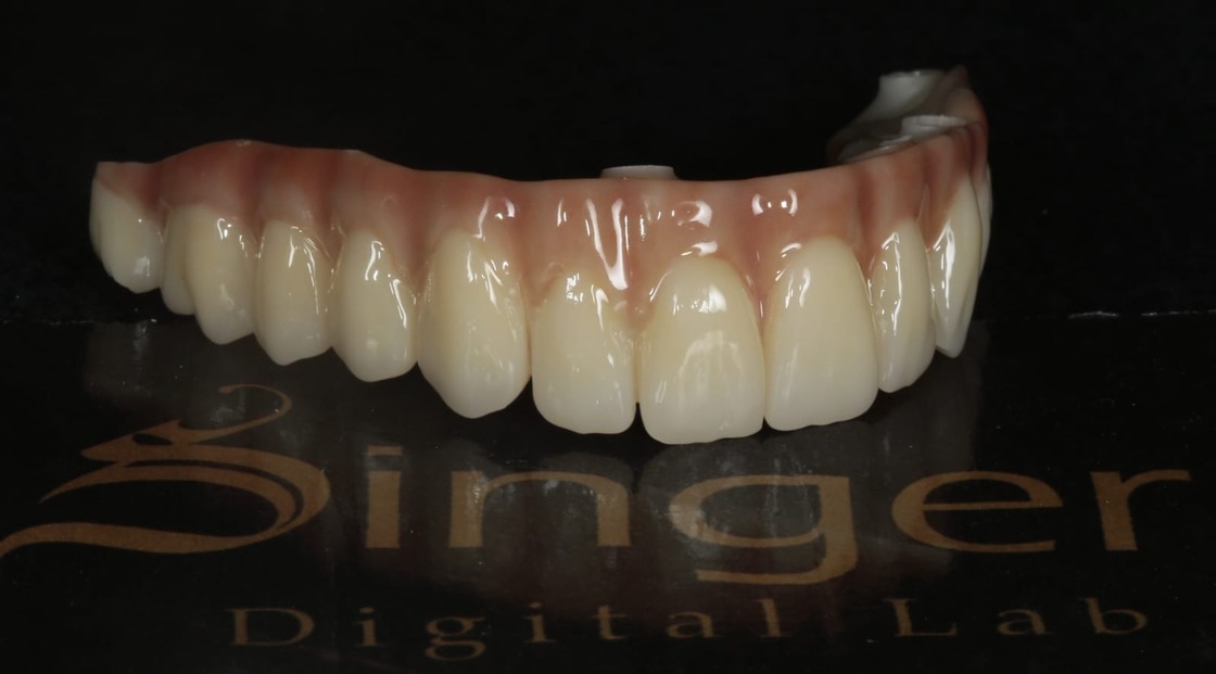 Yucera 4D Pro High - Precyzyjny 3D Wielowarstwowy Blok Cyrkonu Dentystycznego Stabilny i Niezawodny Tworzący Idealne Wyniki Odbudowy