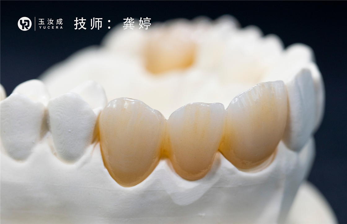 Yucera 3D Plus Multilaer Zirconia Block 98x16mm Otwarty system do korony tylnej